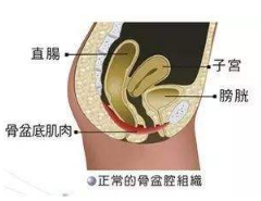 產后盆底肌怎么修復？你得做好盆底功能檢測