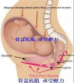 產(chǎn)后盆底康復(fù)治療開始后，出現(xiàn)陰道出血怎么破？