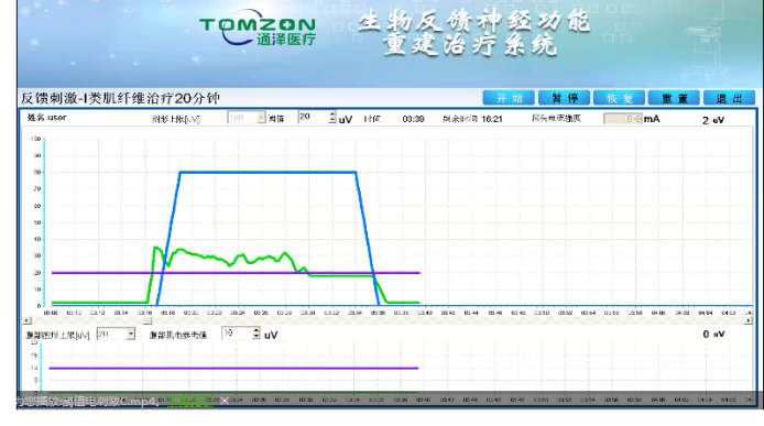 盆底康復(fù)治療怎么做？盆底康復(fù)治療肌電生物反饋治療儀的機(jī)理是什么？