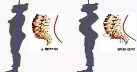 產(chǎn)后康復(fù)干預(yù)措施對產(chǎn)后修復(fù)的促進(jìn)作用研究