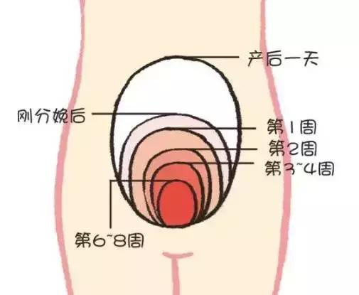 產后康復，什么叫子宮復舊不良？