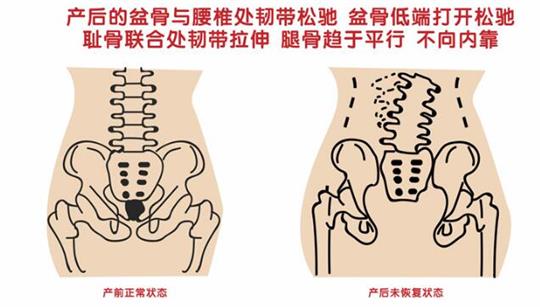 自從知道產(chǎn)后康復(fù)治療儀后，再也不怕腹直肌修復(fù)了