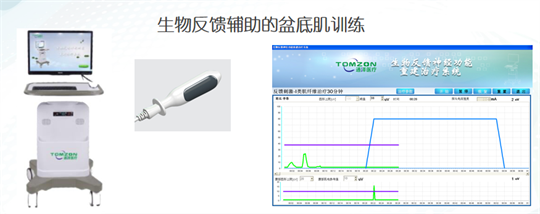 產(chǎn)后修復(fù)|盆底肌肉功能電刺激有什么作用？生物反饋呢？