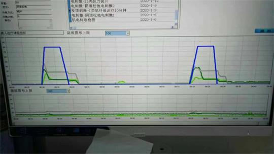 通澤子宮復(fù)舊治療儀器，痛經(jīng)不再是問題