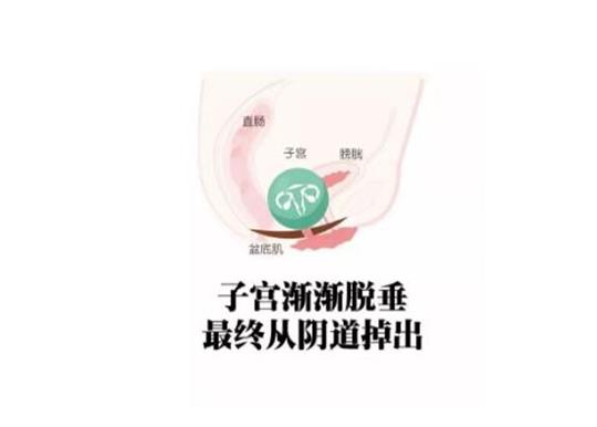 生殖恢復(fù)儀又是怎么幫助二胎寶媽恢復(fù)產(chǎn)前迷人身材