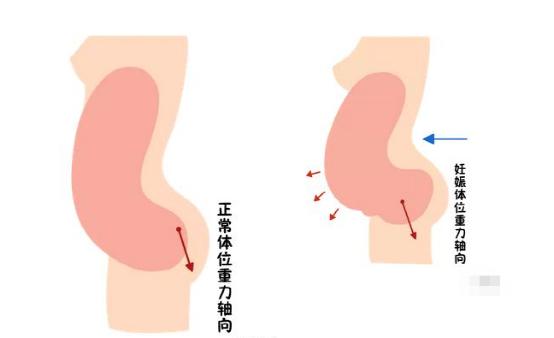 盆底恢復(fù)是否可以使用儀器？