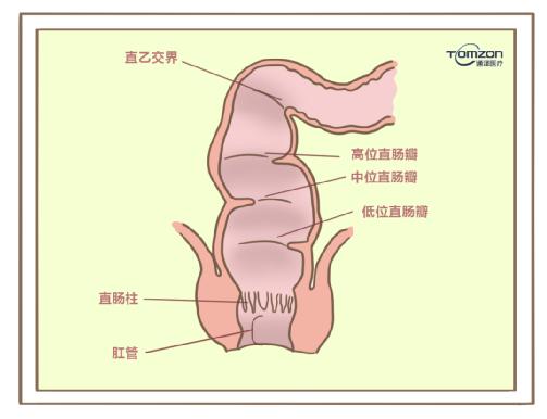 盆底康復(fù)治療儀對產(chǎn)后便秘有哪些幫助？