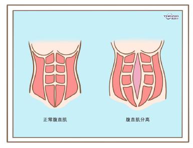 盆底康復(fù)治療儀效果到底怎么樣？