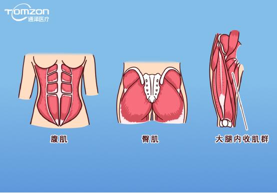 凱格爾運(yùn)動(dòng)該怎么做？盆底肌修復(fù)儀器還能用嗎？