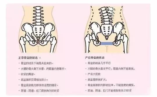 腹直肌修復