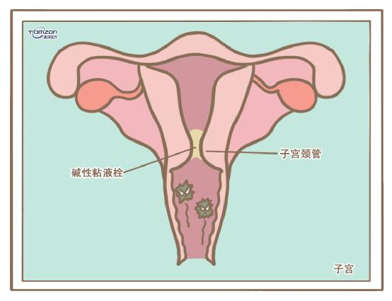 盆底康復(fù)治療儀